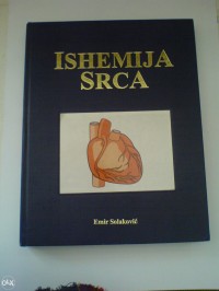 Image of Ishemija srca
